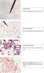 Does not grow in presence of optochin and bile b live strain, attenuated by loss of its protein capsule. Staining Technology And Bright Field Microscope Use Springerlink
