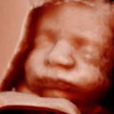 is 3d or 4d ultrasound better safety