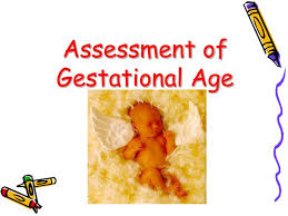 Ppt Assessment Of Gestational Age Powerpoint Presentation