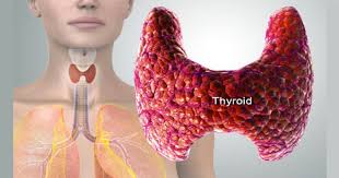 Image result for Exactly What to Do If You Suspect Thyroid Problems