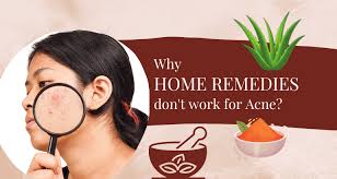 home remes don t work for acne scars