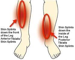 prevention and treatment for shin