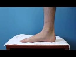 Longitudinal arch, differ in that the anterior part of the foot is medially twisted on the. Fix Flat Feet Exercise For Fallen Arches Youtube Flat Feet Exercises Foot Exercises Flat Feet