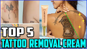 top 5 best tattoo removal cream to