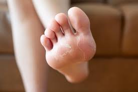 skin conditions of the feet oregon