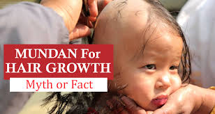It is getting more and more. Is Mundan Helpful In Hair Growth In Babies