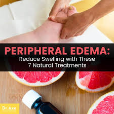 peripheral edema symptoms 7 natural