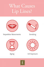 how to get rid of lip lines in 3 easy