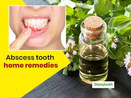 abscessed tooth here are 8 useful home