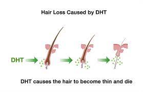 hormonal hair loss treatment atlanta