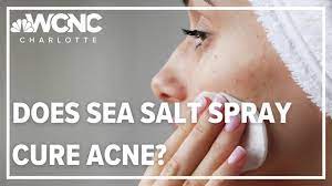 sea salt spray cure my acne overnight