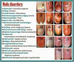 The Nails Have It Medical Facts Nail Disorders Health