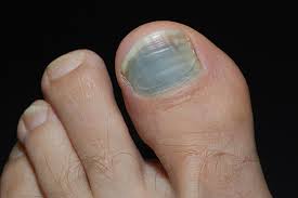 your toenails tell about your health