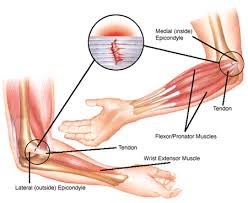 outer elbow pain from weight lifting