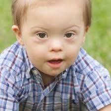 Each year, about 6,000 babies are born with down syndrome, which is about 1 in every 700 babies born. How Frequently Does Down Syndrome Occur Ask Dr Sears