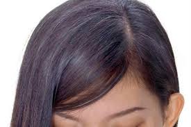It is a dominant genetic trait. Use These Oils To Darken Hair Naturally Uses And Simple Diy Recipes