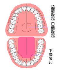 歯や顎に加わる過重 歯ぎしり 骨隆起 -秋本歯科医院