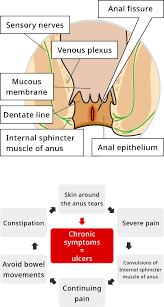 characteristics of fissure