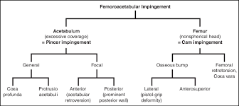 Flowchart Shows Classification Of Types Of Femoroacetabular
