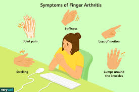 Pain in the finger joints, usually while using your hand, may be the first sign of arthritis. Finger Arthritis Signs Symptoms And Treatment