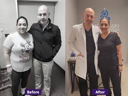 mexico bariatric services affordable