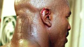 did-holyfield-lose-his-ear