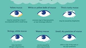 In such a condition, the individual visualizes small specks floating or moving before their eyes mainly well to make a long story short, i don't know how the brain does it but somehow a month later i don't even notice it at all. Types Of Eye Mucus Discharge And Boogers