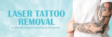 best laser tattoo removal clinic kuala