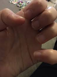 how to stop biting your nails b c guides
