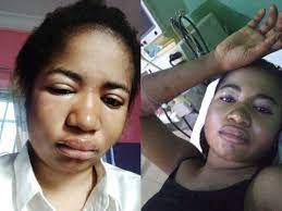 Odumeje finally forgives ada jesus and also gave her 1 million. Comedienne Ada Jesus Dead After Battle With Kidney Diseaseguardian Life The Guardian Nigeria News Nigeria And World News