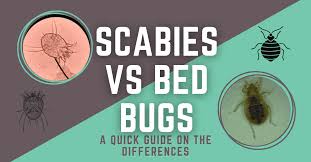 scabies vs bed bugs quick guide to