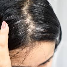 does low vitamin d cause hair loss