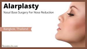 alarplasty nasal base surgery for nose