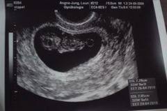 Ssw ultraschall weitere tipps für die ssw 10 zu beginn der 10. 10 Schwangerschaftswoche 10 Ssw Alle Infos Eltern De