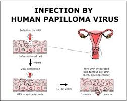 human papillomavirus hpv infection