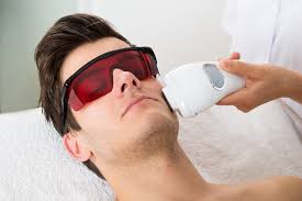 get laser hair removal on your face