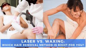 laser vs waxing which hair removal
