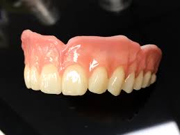 a study on digital dentures case