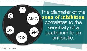 What Does Zone Of Inhibition Mean And How To Measure It