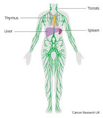 Lymphoma is a broad term for cancer that begins in cells of the lymph system. About Hodgkin Lymphoma Cancer Research Uk