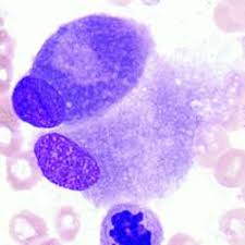 Image result for Osteoblasts