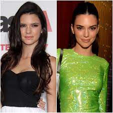Has Kendall Jenner Had Plastic Surgery ...