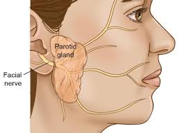 parotid gland tumours and parotidectomy