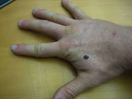 Image result for index finger acupressure points