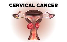 cervical cancer diagnosis gynecoloncol