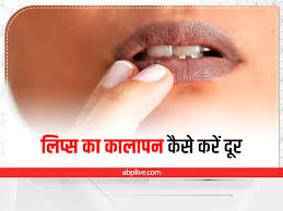 natural remes for pink lips in hindi