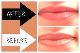 how to fix chapped lips fast you