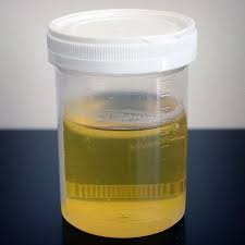 urine composition characteristics