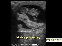 Bovine Ultrasound Images 34 To 71 Days Boviscan Hd