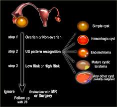 The Radiology Assistant Ovarian Cysts Diagnostic Work